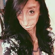 Lien d le pour la 3ème année consécutive, sam le chien de susie lockheed a gagné le concours du chien le plus moche du monde. La Revanche De Lizzie Velasquez La Femme La Plus Laide Du Monde Marie Claire