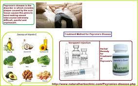 Pin On Natural Herbs