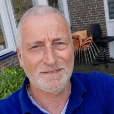 bionic #amputee #prosthesis