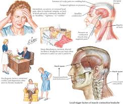 Image result for Acute Localized Headache