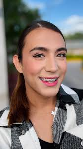 Hoy me quitan mis brackets 😬 no sé cómo sentirme 🥹 #comedy