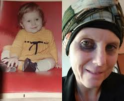 Cerco la mia mamma naturale per salvarmi dal tumore”