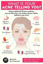 7 Most Susceptible Pimple Breakout Points And Why Beauty Skin Care Routine Skin Care Acne Acne Skin