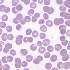 Clinical manifestations of plasmodium falciparum infection are induced by the asexual stages of the parasite that develop inside red blood cells (rbcs). Malaria Image Library P Knowlesi Page 3