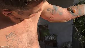 Tattoo removal may soon be easier. Jackass Vet Steve O Is In Hospital Daily Mail Online