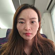 Permission to post admin, makiki daan lang po. Carbon laser for Oily Skin  control or skin pigmentation removal like Melasma and Acne Scars. Book for  your appointment today! @ Roselyn's wellness and