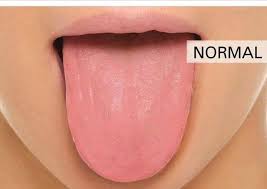 Asi Luce Una Lengua De Terapias Complementarias Chile Facebook