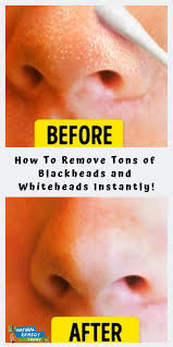 Maybe you would like to learn more about one of these? Pin On Skin Care