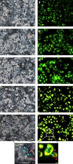 As with other similar cathinones, craving (the craving for the substance, lethargy) is very. The New Psychoactive Substance 3 Methylmethcathinone 3 Mmc Or Metaphedrone Induces Oxidative Stress Apoptosis And Autophagy In Primary Rat Hepatocytes At Human Relevant Concentrations Springerlink