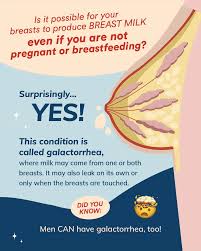 Image result for Galactorrhea