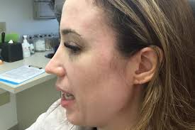 Cosmetic Surgery Procedure Gallery