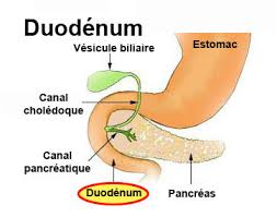 Duodenal cancer is a rare tumor that occurs less than 1% compare to other cancers. Cancer Du Duodenum Symptomes Traitement Definition Docteurclic Com