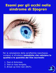 La sindrome di sjogren, conosciuta anche come sindrome sicca viene definita come malattia infiammatoria che può colpire molte parti dell'organismo, danneggiando principalmente le ghiandole la sindrome di sjögren primaria si verifica nei pazienti non colpiti da altre malattie reumatiche. Sindrome Di Sjogren E Dolori Muscolari Sintomi E Terapia