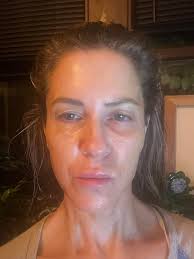 Why the beauty obsession?': Apoorva Mukhija gets face-lift injections at  24; netizens say she's ruining her youthful skin #apoorvamukhija