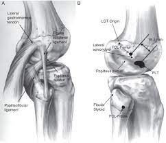 The lateral or outside collateral ligament (lcl) connects the femur to the smaller bone in the lower leg (fibula). Injuries To Posterolateral Corner Of The Knee A Comprehensive Review From Anatomy To Surgical Treatment Sciencedirect