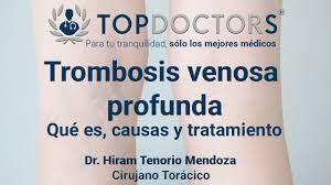 Ya por el siglo 19, el médico alemán rudolf virchow había determinado los tres factores predisponentes en la patogénesis de la trombosis intravascular. Causas De La Trombosis Venosa Profunda Conoce Como Prevenirlas Youtube