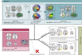 Tan associates was incorporated on 23 may 1989 (tuesday) as a sole proprietor in singapore. The Benefit Of The Diffusion Kurtosis Imaging In Presurgical Evaluation In Patients With Focal Mr Negative Epilepsy Scientific Reports