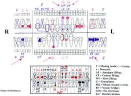 Clean How To Chart Dental Restorations Does Atraumatic