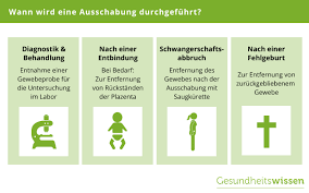Eine ausschabung ambulant (ohne vorangegangene schwangerschaft nach langer starker blutungsdauer). Ausschabung Implikation Ablauf Risiken