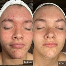 Licensed esthetician and student massage therapist in Lawton