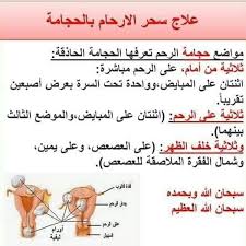 المحيط الهادئ محو يعالج كتاب تعليم الحجامة بالصور guillotinpoilvet com