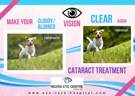 Cloudy Or Blurred Vision In Your Eyes It May Be Because Of Cataract Neera Eye Center Delhi Offers Excellent And Advanc Cataract Visions Cataract Surgery