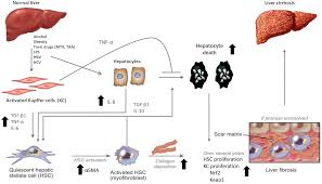 Occasionally, liver disorders occur postoperatively. Plos One Pro Fibrotic Compounds Induce Stellate Cell Activation Ecm Remodelling And Nrf2 Activation In A Human 3d Multicellular Model Of Liver Fibrosis