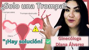 Can I get pregnant with only one tube? 😱🤰🏻