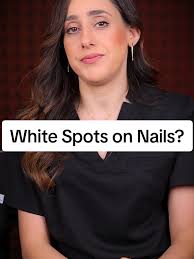 حل خاص لبقع الأظافر البيضاء كراتين جرانوليشن