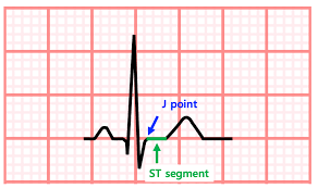 Image result for J Point