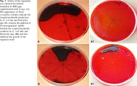 Migliaia di nuove immagini di alta qualità aggiunte ogni giorno. Ability Of The Organisms Was Checked For Biofilm Formation In Bhi Agar Download Scientific Diagram