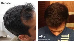 This treatment can be done as often or little as you feel you need. How To Mix Hair Oils For Hair Growth Quora