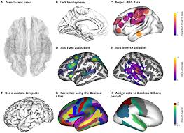 ℹ️ gpuofthebrain > gpuofthebrain memberikan informasi yang bersumber dari aplikasi, apk, apps, teknologi, viral, review dan investasi jangka panjang, serta pendidikan. Frontiers Visbrain A Multi Purpose Gpu Accelerated Open Source Suite For Multimodal Brain Data Visualization Frontiers In Neuroinformatics