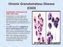 Nbt test previous question papers pdf content list related nbt test previous question papers are : Disorders Of The Immune System Dr Bikramajit Singh Saroya Windsor University Som Ppt Download