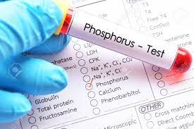 Erleben sie günstige preise und viele kostenlose extras wie proben & zeitschriften. Blood Sample For Phosphorus Test Stock Photo Picture And Royalty Free Image Image 100348792