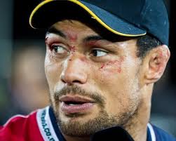 Shane Christie, rugby concussion campaigner who wanted to donate his brain,  found dead at 39