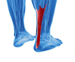 This tendon is located on the back portion of the foot just above the heel. Achilles Tendinitis Treatment Symptoms And Causes