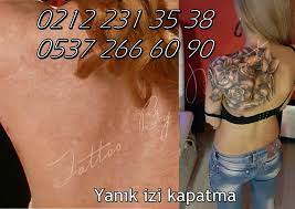 Dövme uygulaması yapacağınız bölgeye aydınger kağıdı koyun! Clown Sayfa 3 Dovmecimizistanbul