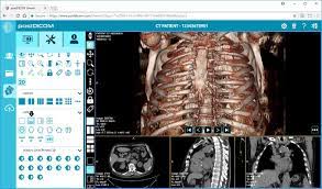 Maybe you would like to learn more about one of these? Top 15 Free Dicom Viewers