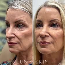 Took some time off from posting but we're back and ready to show you what  we've been up to 😍 First round of her treatment plan is done and the  results are