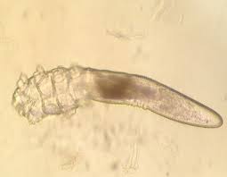 Image result for Demodex brevis