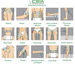 How To Use Electrode Pads Csa Medical Supply Blog Ten Unit Tens Unit Therapy Tens Unit Placement