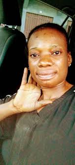 How do I get rid of my blackheads all over my face