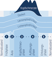 Migraneanfall Ablauf