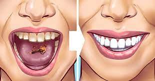 Sensitive + enamel shield, cph healthy fresh 10 Ways To Remove Tartar Stains From Your Teeth