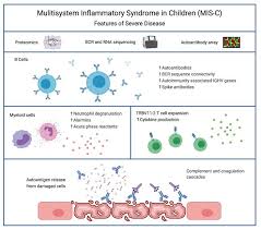 Image result for Multisystem Inflammatory Syndrome
