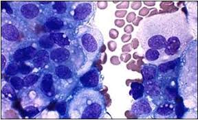 Bladder cancer is a disease that usually begins in the cells that line the inside of the bladder. Bladder Tumor Animal Cancer And Imaging Center