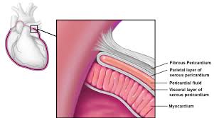 Pericardial Disease