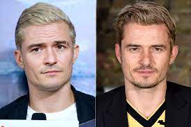 In 2014, orlando bloom had long hair that he sometimes pulled into a bun. Orlando Bloom S Blonde Hair Is Going Through An Evolution People Com