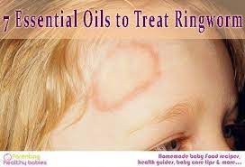 7 Essential Oils To Treat Ringworm In Children Essential Oils For Ringworm Essential Oils For Babies Essential Oils For Skin
